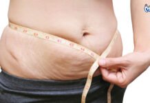 Come perdere peso dopo la gravidanza? 3 modi efficaci