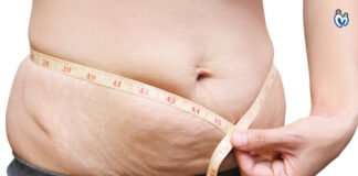 Come perdere peso dopo la gravidanza? 3 modi efficaci