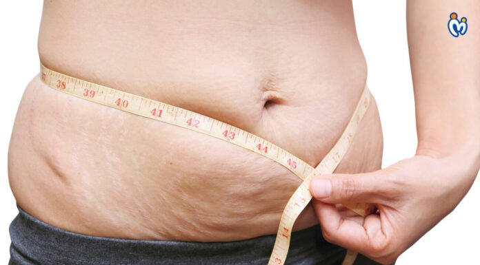 Come perdere peso dopo la gravidanza? 3 modi efficaci