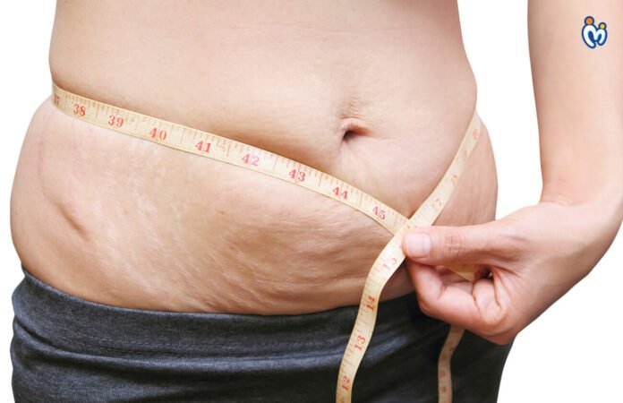 Come-perdere-peso-dopo-la-gravidanza-3-modi-efficaci.jpg